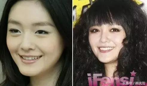 给你一万块买裤子还是买衣服,护肤和微整