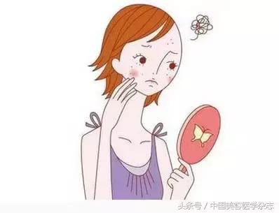 青春期痤疮中药治疗,青春期长疮怎么消除