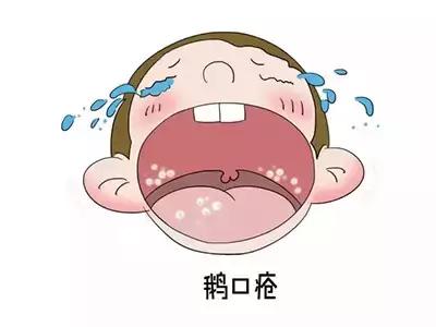 宝宝鹅口疮月嫂奶具消毒不到位吗,月嫂小儿护理