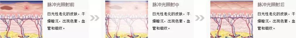 资生堂紧急召回41万件安耐晒？谨慎你的脸！