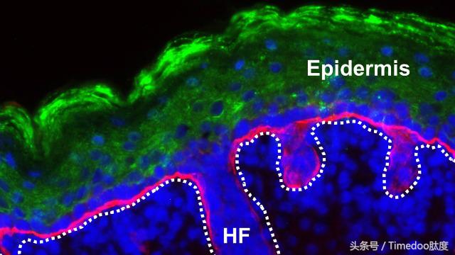 crispr和干细胞治疗二型糖尿病,crispr基因编辑技术治疗癌症