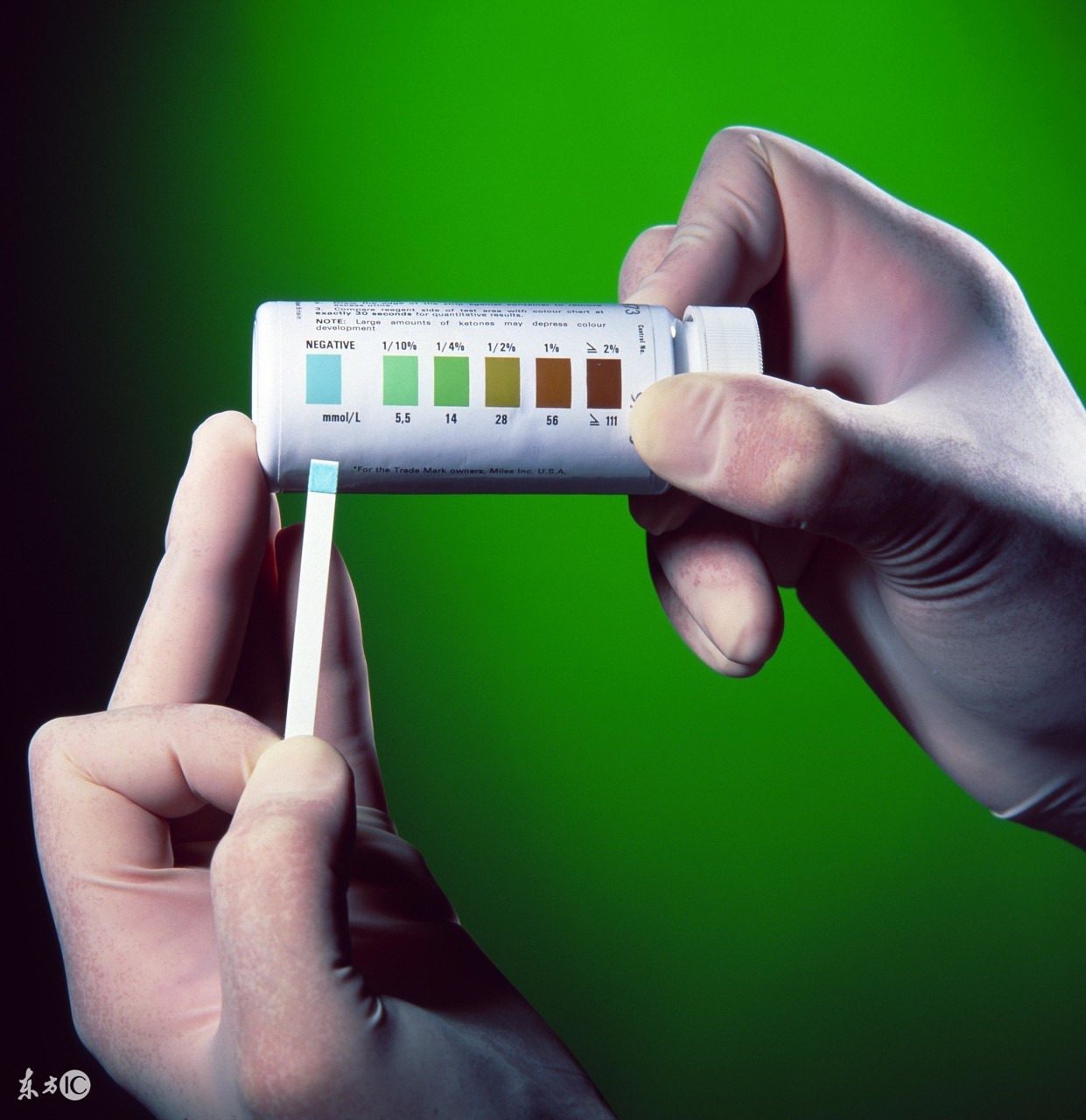 过敏性紫癜引起的尿潜血怎么治疗,过敏性紫癜隐血弱阳性说明了什么