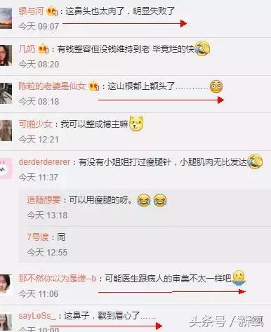 做了个达拉斯隆鼻，假体直接戳到脑门，我是不是和张檬、刘雨欣遇到了同一个医生！