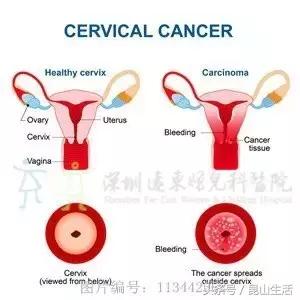 上大厕总是被水溅到,你们上厕所有被水溅到过吗
