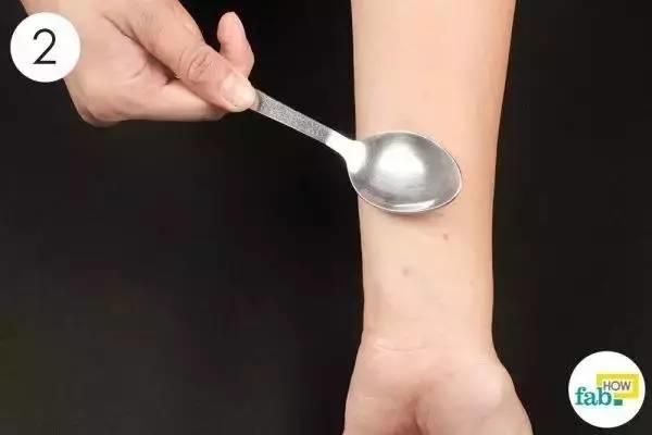 蚊子咬了最有效的止痒方法,蚊子咬了有什么止痒方法