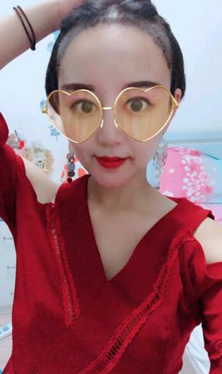 植发手术后一劳永逸了,植发做了两次以后还有毛囊可做吗