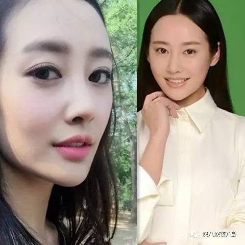 自从割双眼皮不算整容之后，娱乐圈不微调的女艺人是真·不存在