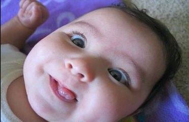 婴儿鬼脸综合症症状图,1岁4个月鬼脸综合症能治好吗