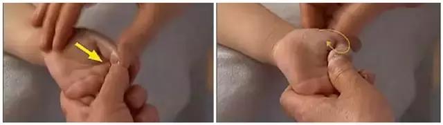 穴位埋线治湿疹多久才有效果,儿童湿疹的食疗