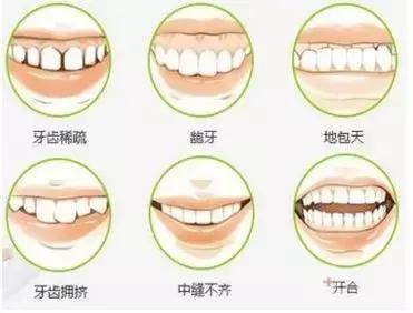 全口牙套的种类和价格,矫正牙套种类及价格表