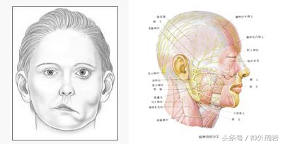 面肌痉挛轻微一直不治疗可以吗,面肌痉挛手术后耳朵听不到怎么办