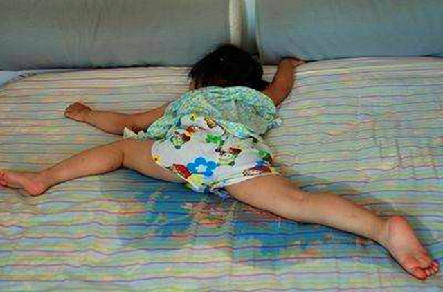 小儿糖尿病会有哪些症状,宝宝多饮多尿是糖尿病吗