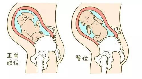 孕前期见红中后期需要关注什么,孕中后期关注事项