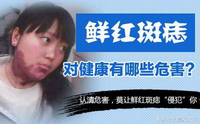 孩子有胎记一般都是怎么造成的,家长该了解胎记的五种类型