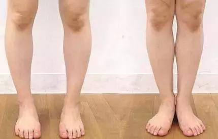 30岁之后关节会快速退化，有这6个习惯的人要谨慎！