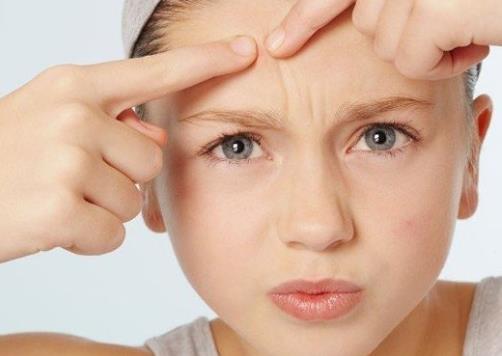 消除痘痘和痘印最简单的方法,很严重的痘痘痘印怎么消