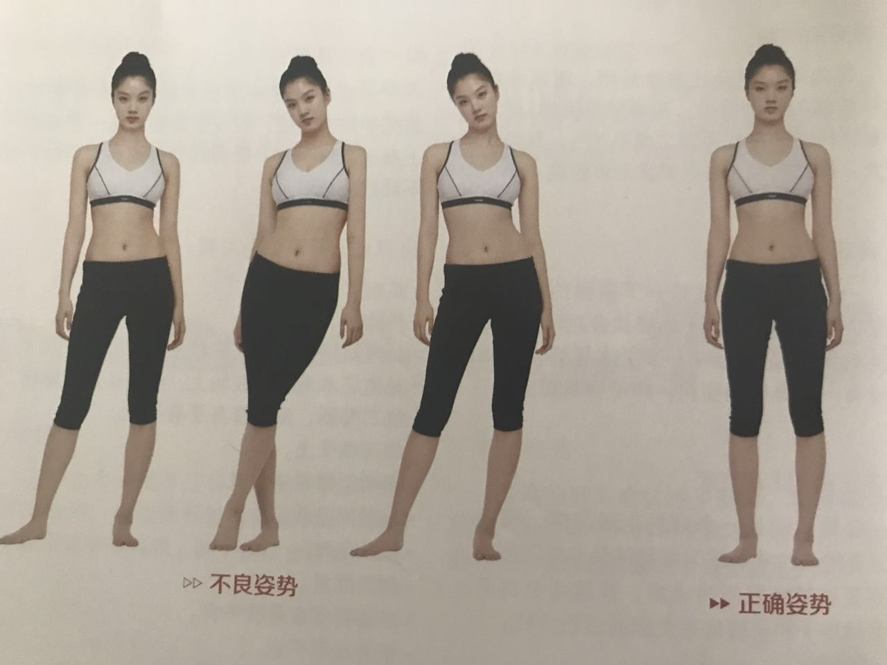 乌龟脖肿,儿童乌龟脖纠正动作