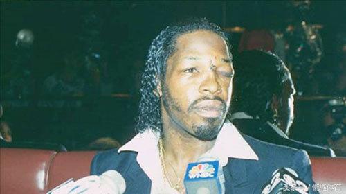 为什么拳击比赛戴拳套,拳击比赛戴着拳套还会重伤对手吗