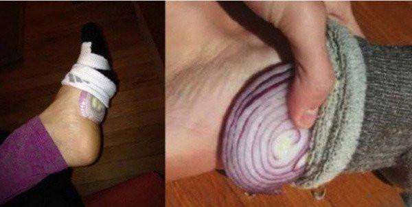 洋葱对男性有好处吗,洋葱对男性好处