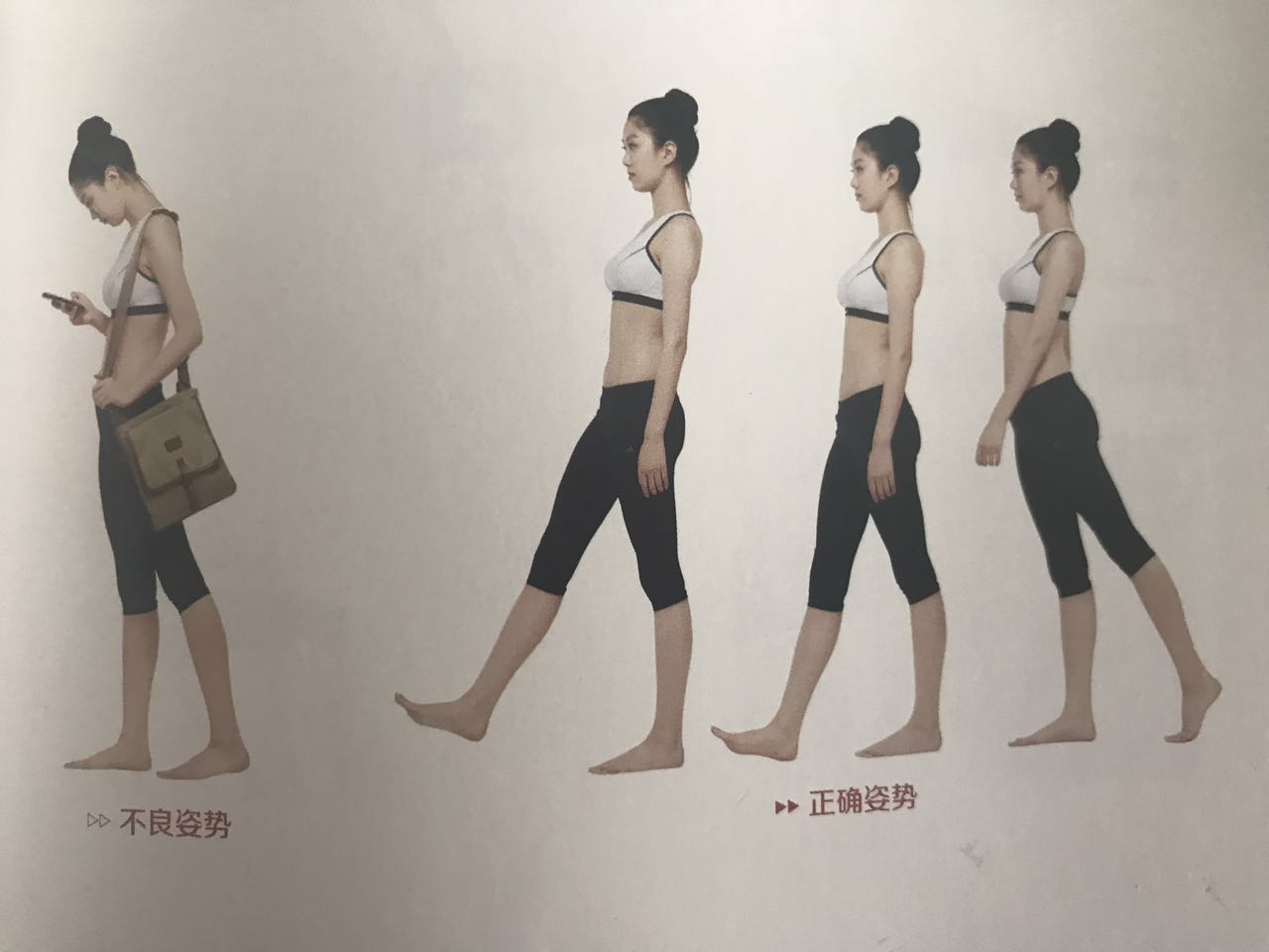 乌龟脖肿,儿童乌龟脖纠正动作