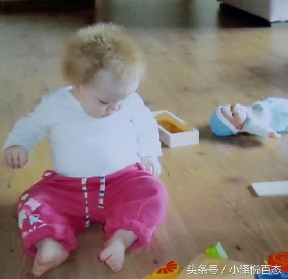 澳大利亚女性蓬发综合症,澳大利亚女孩难梳头发综合征