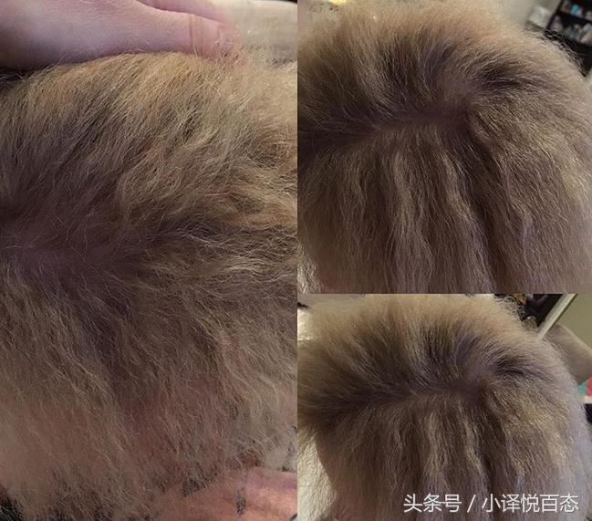 澳大利亚女性蓬发综合症,澳大利亚女孩难梳头发综合征