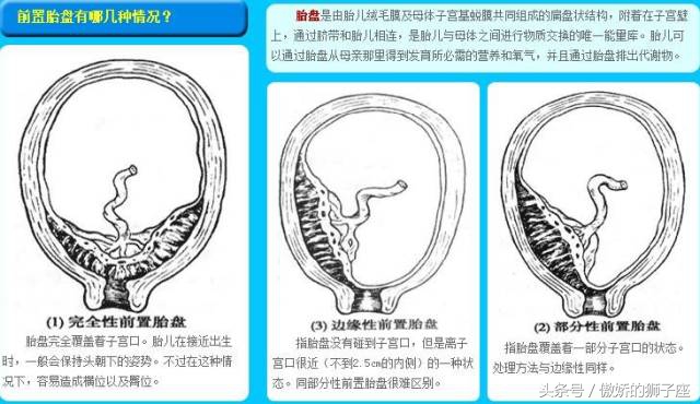 准妈妈必须谨慎保健误区,准妈妈孕期禁忌
