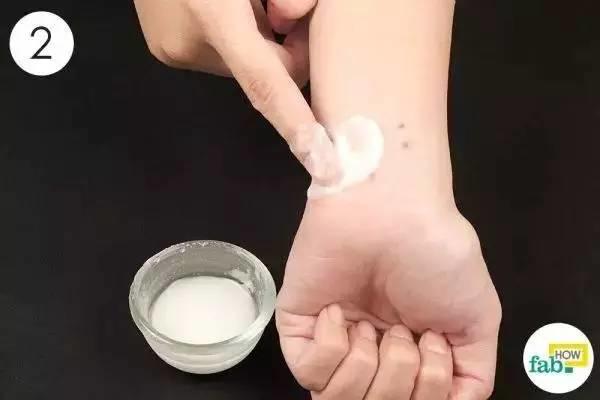 蚊子咬了最有效的止痒方法,蚊子咬了有什么止痒方法