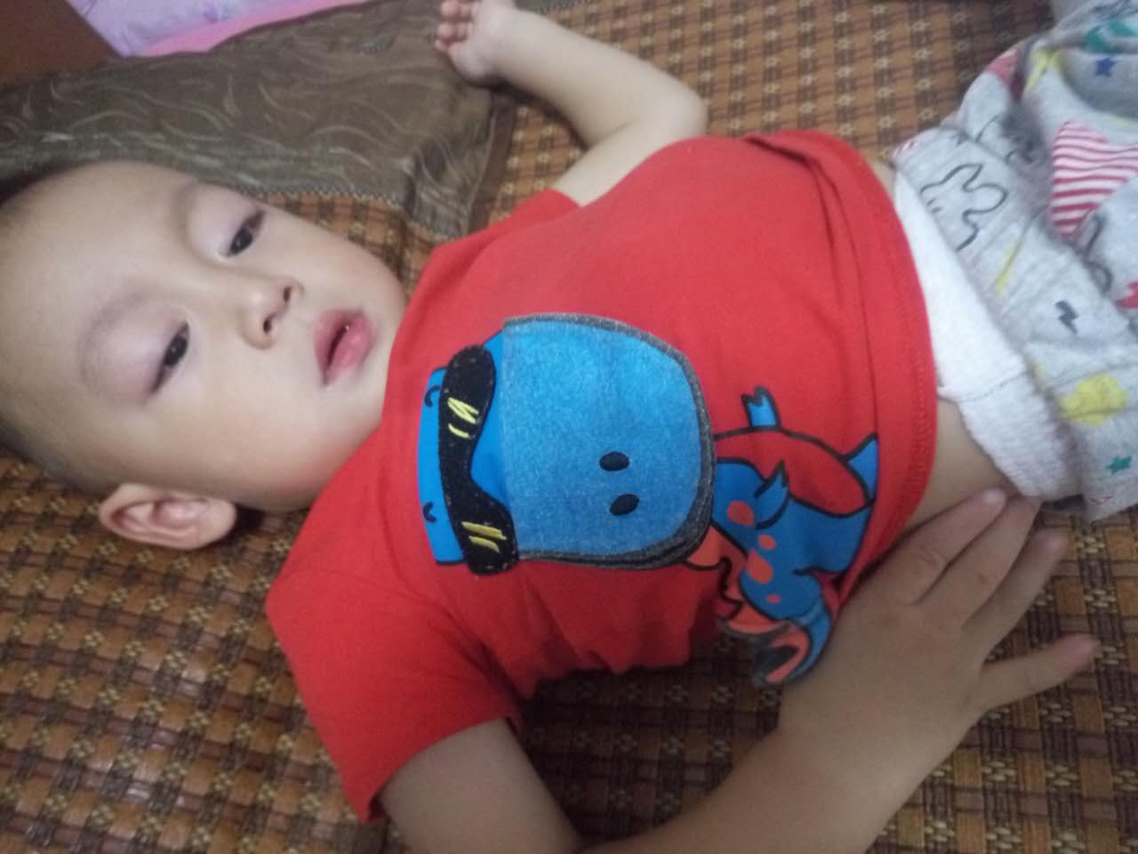 手足口病会传染成疱疹性咽峡炎吗,得了手足口还得疱疹性咽峡炎吗