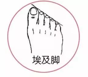 为什么穿鞋脚趾那么疼,为什么不管穿哪双鞋子小脚趾痛