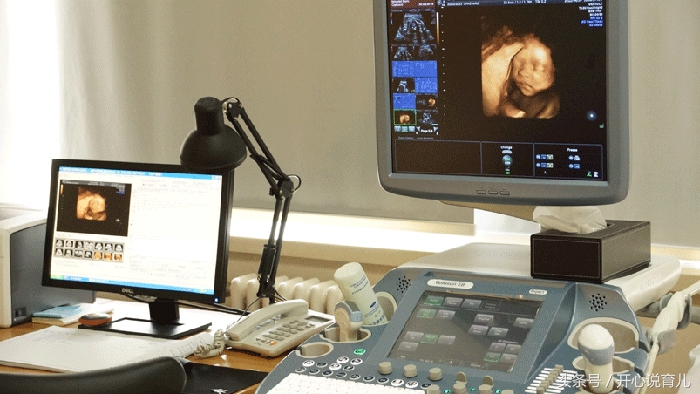 孕妇四维彩超跟大排畸有什么区别,孕期四维大排畸几周做最合适