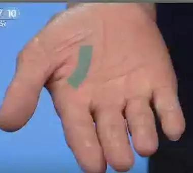 手是人体的重要器官,手上的健康秘密