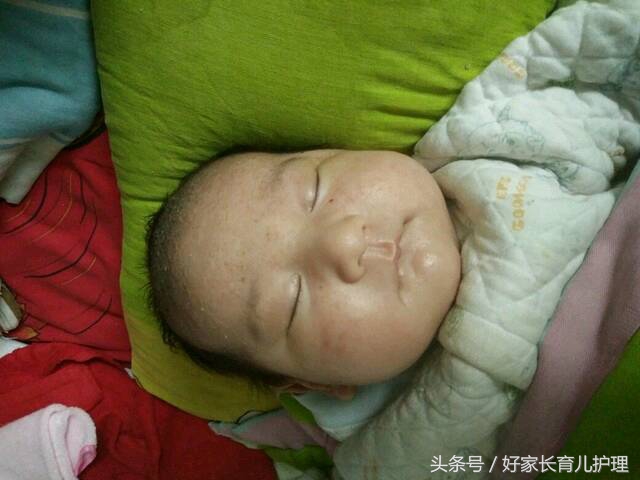 宝宝湿疹医生开什么药,宝宝湿疹怎么给宝妈解释