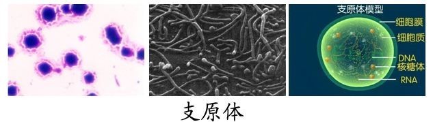 女性支原体感染的那些事儿