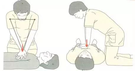 牡丹江市第一人民医院｜“救命”之心肺复苏操作法