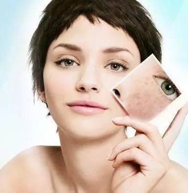 孕期长斑生完孩子后消失吗,孕期长斑怎么控制和消除