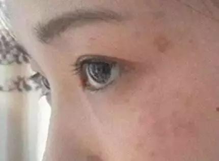 护肤品含香精对皮肤有什么危害,护肤品含汞对人体的危害