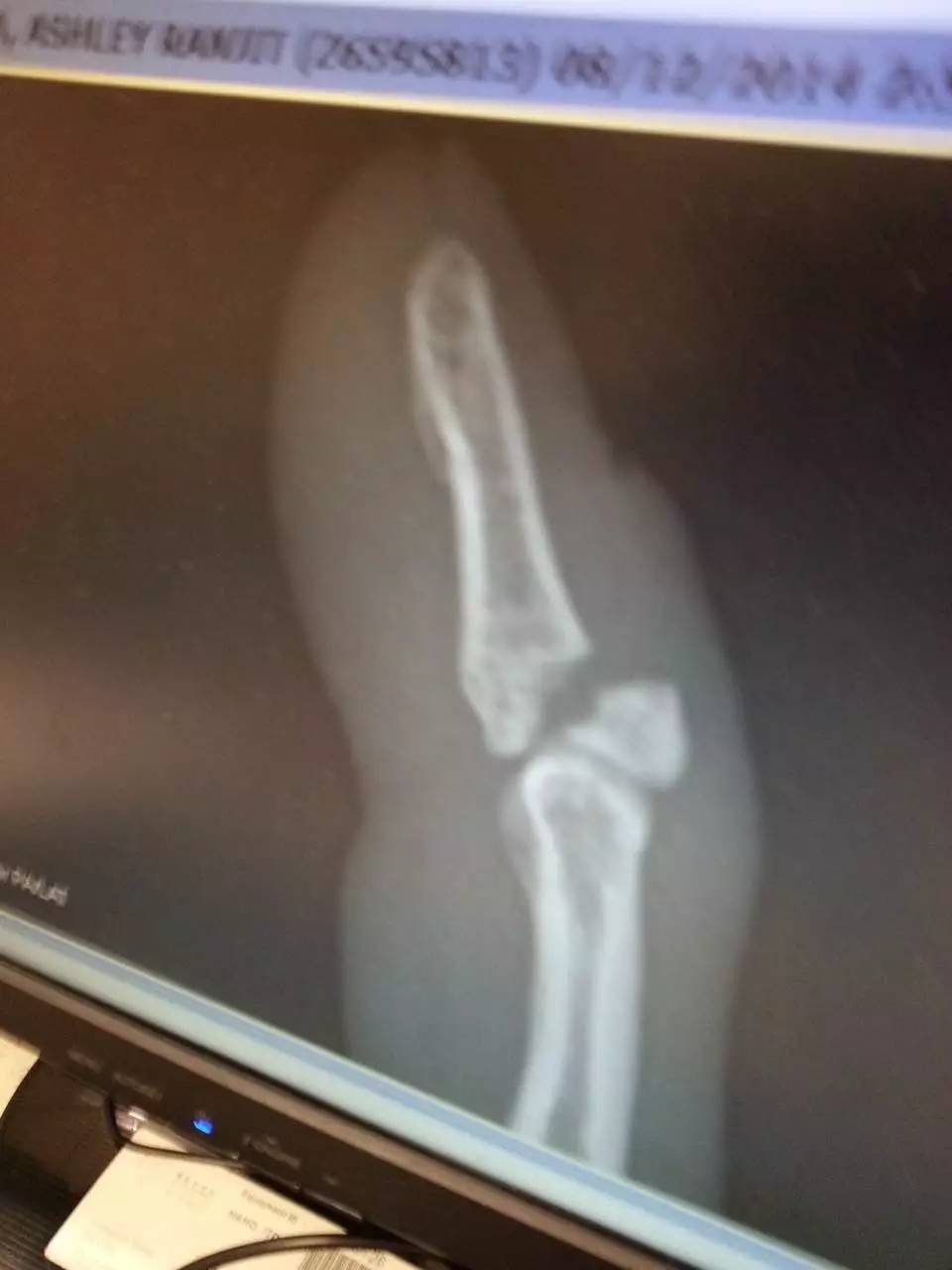 技术最好的摔角手,和伤病抗争八年