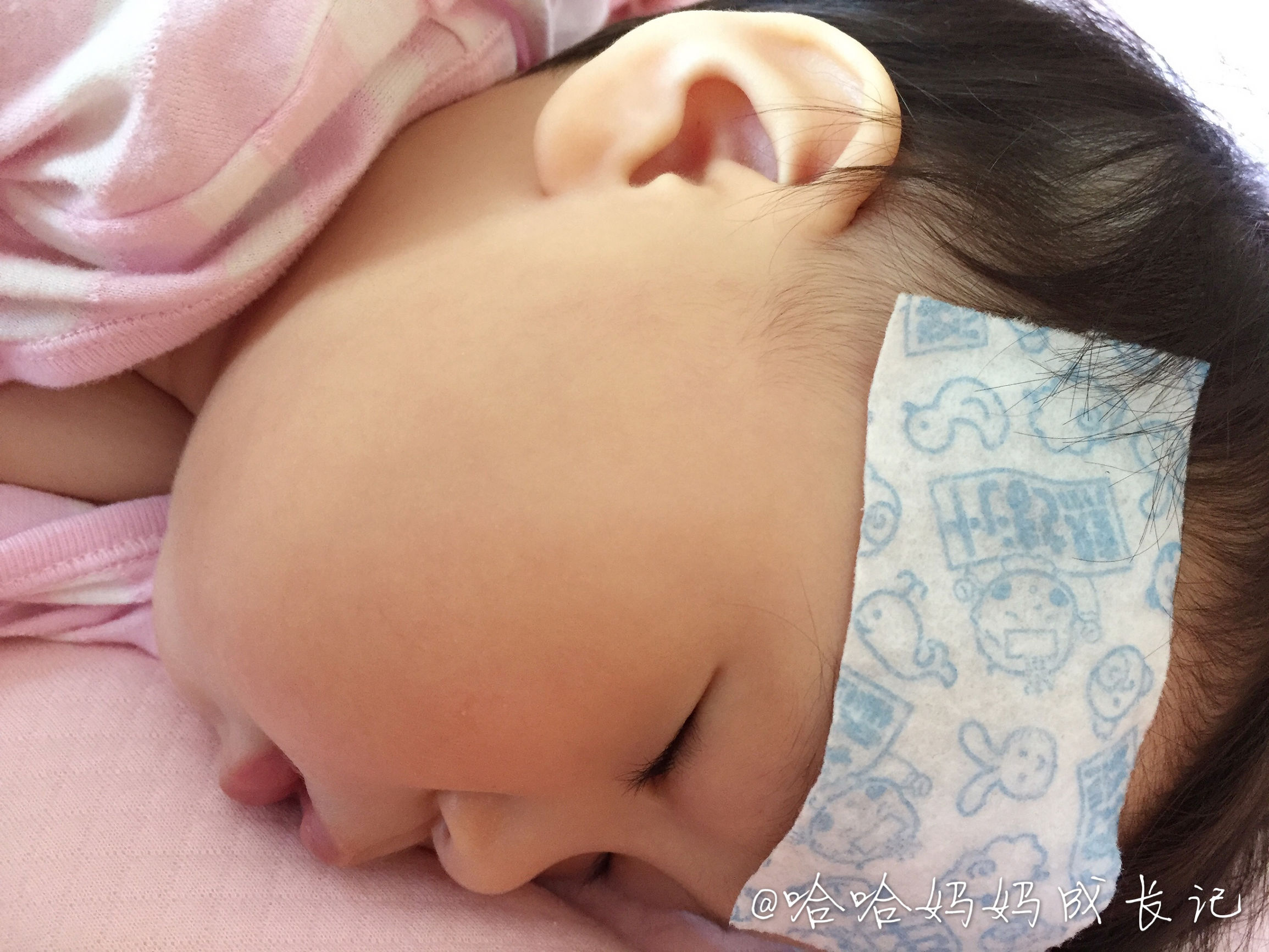 幼儿急疹真实经历,幼儿急疹没那么可怕