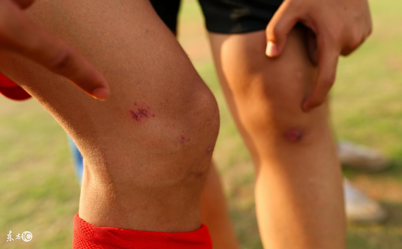 黄博文复出恒大,黄博文张琳芃伤退上港恒大