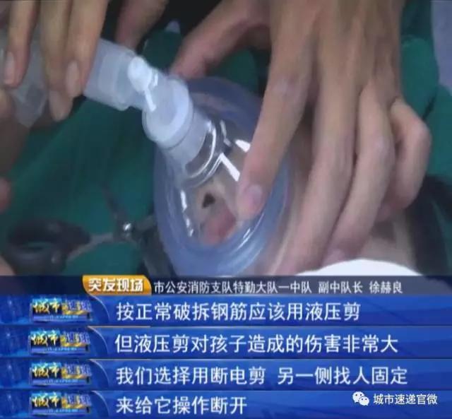 剪刀戳伤小朋友,剪刀戳伤孩子