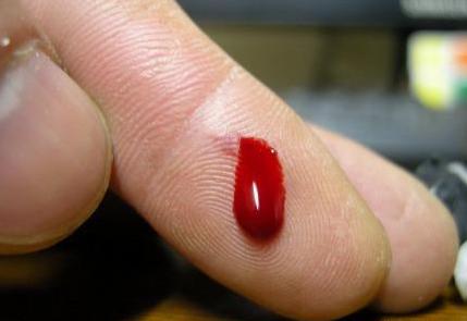 肝癌早期的症状一定要重视了,必知肝癌初期症状关键时候能救命