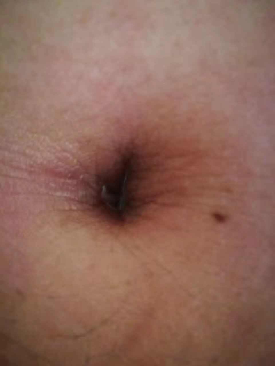 病人不忌口一览表,病人不忌口医生跑断腿什么意思