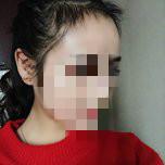 大额头适合用什么植发,大额头发际线高怎么办