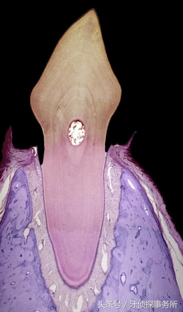牙齿为什么和牙肉分离,牙床与牙齿分离是什么原因