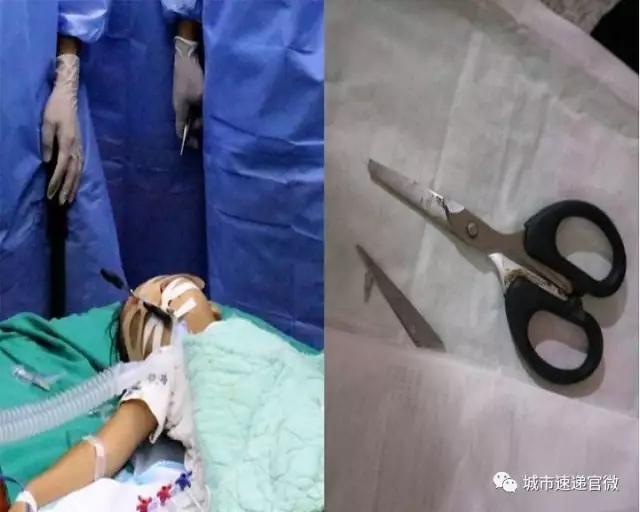 剪刀戳伤小朋友,剪刀戳伤孩子