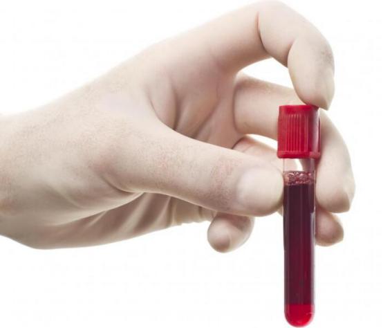 得了肿瘤癌胚抗原一定会升高吗,癌胚抗原升高意味肿瘤复发