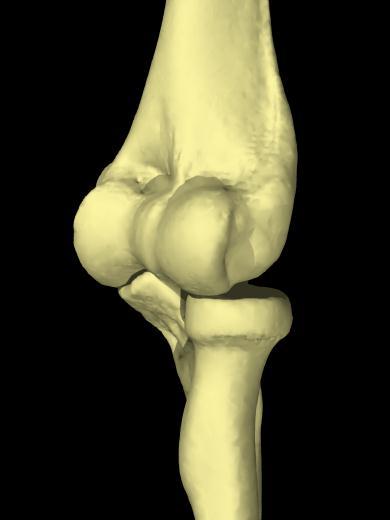 4岁左桡骨小头骨皮质断裂,小孩桡骨小头发育缺失