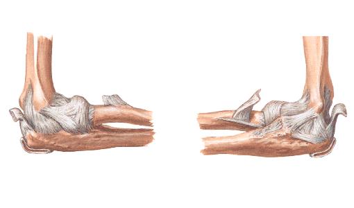 4岁左桡骨小头骨皮质断裂,小孩桡骨小头发育缺失