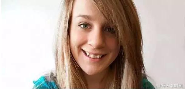 戴了牙套后嘴唇会变薄吗,戴牙套后会导致嘴变凸吗